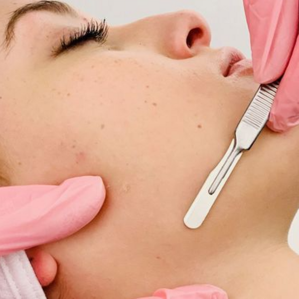 Dermaplanning 