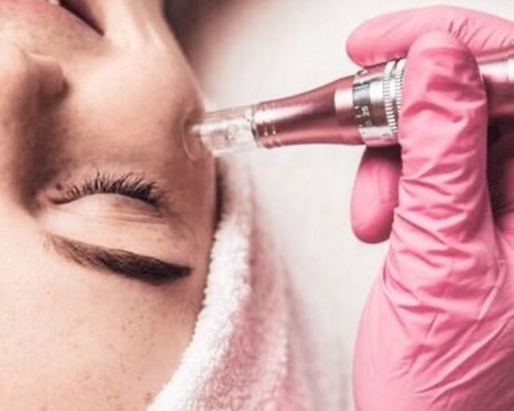 Hydrapeel con dermapen