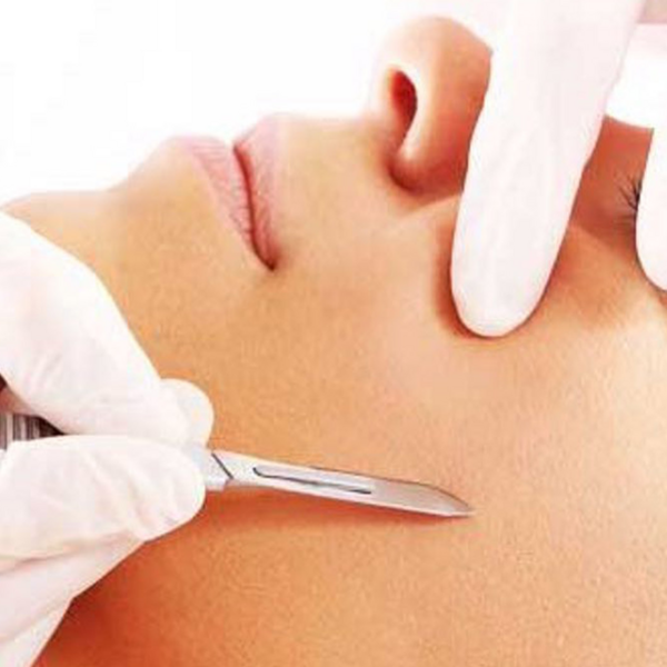 Dermaplaning