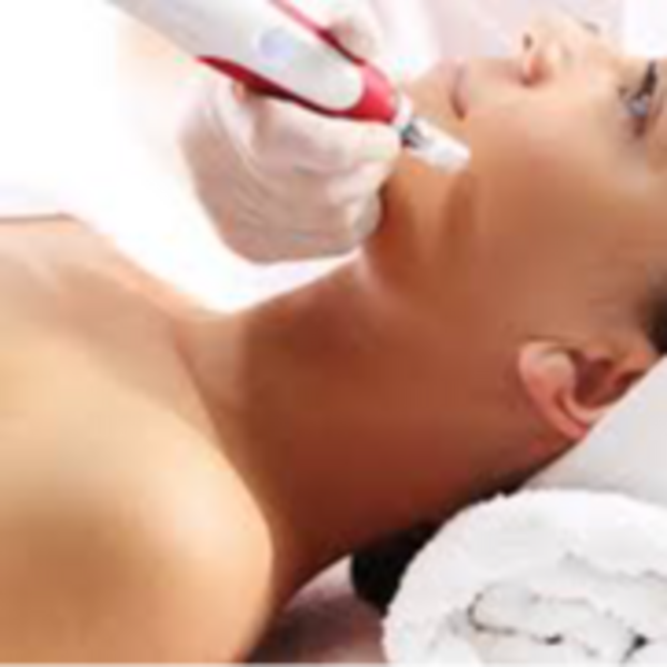 Dermapen Labios
