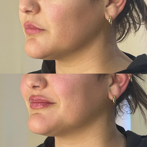 Diseño de labios