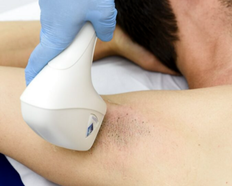 Depi hombre cuerpo completo