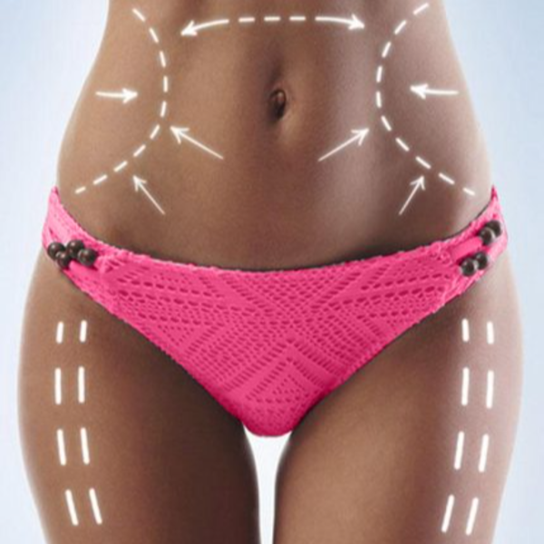 Criolipolisis + masajes 