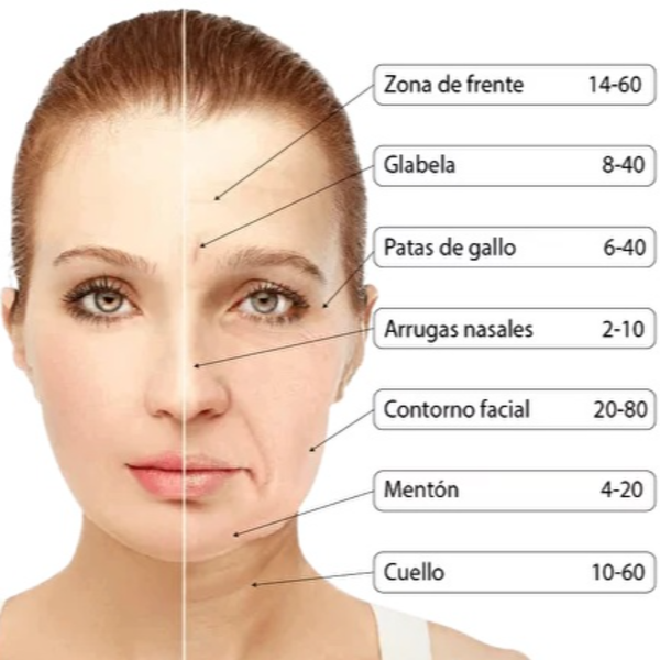 Botox 1 zona