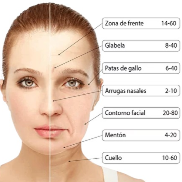 Botox entrecejo 