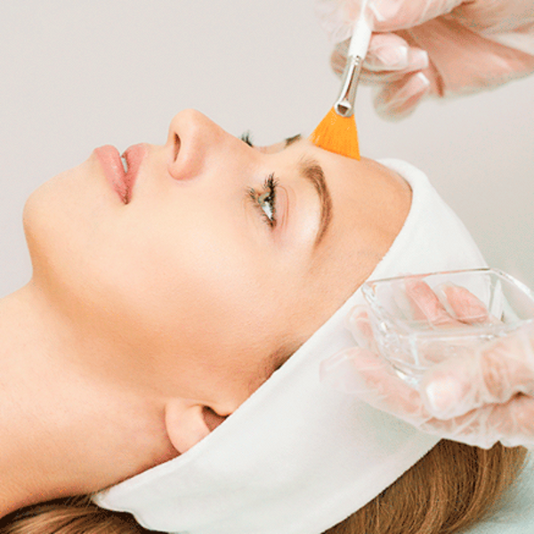 Peeling quimico 