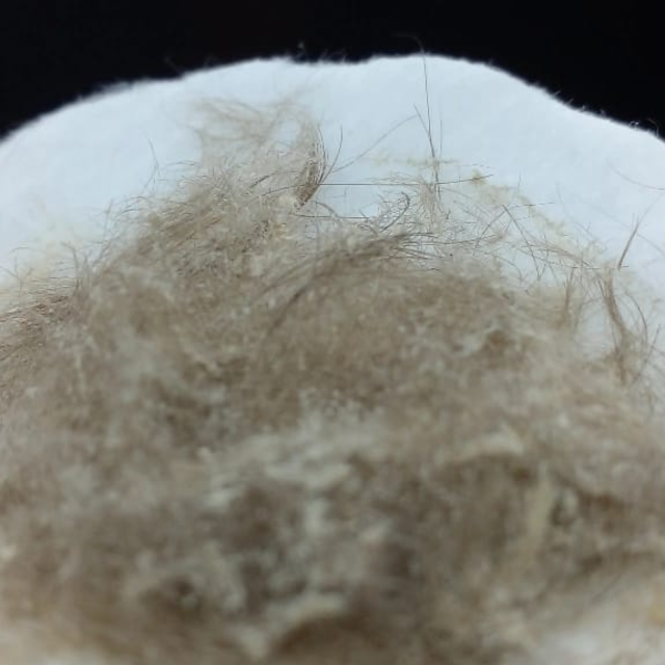 HIGIENE FACIAL PROFUNDA CON DERMAPLANING