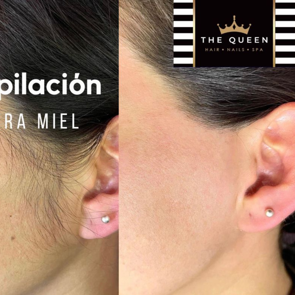 Depilación Patillas