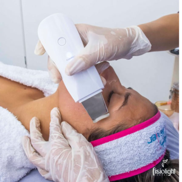 PEELING ULTRASÓNICO CON ÁCIDOS