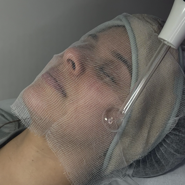 Limpieza Facial 