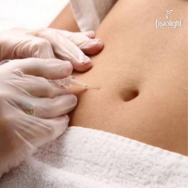 CARBOXITERAPIA ABDOMEN