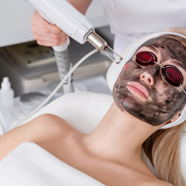 Hollywood Peel