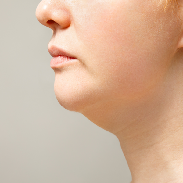 Hifu Papada y Cuello