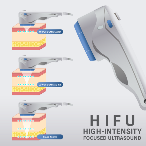 Hifu Piernas