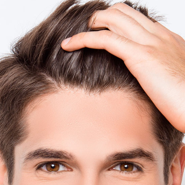 Mesoterapia capilar con Vitaminas y Nutrientes