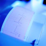 Electrocardiograma