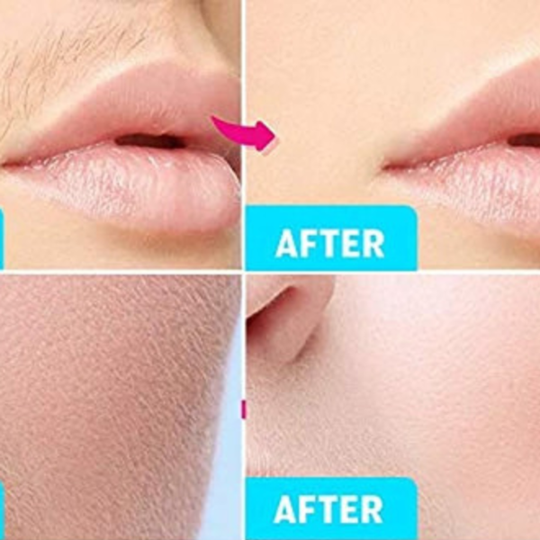 Depilación facial