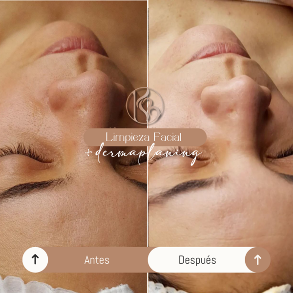 Limpieza facial profunda + Dermaplaning 