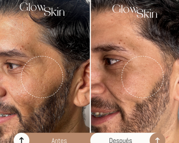 Glow Skin