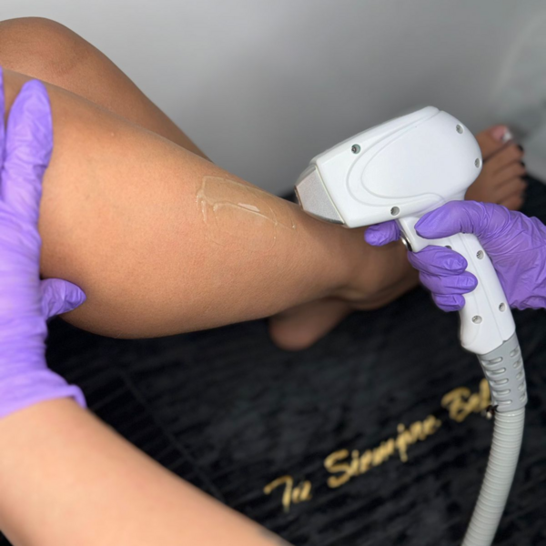 Laser Bigote Sesión 