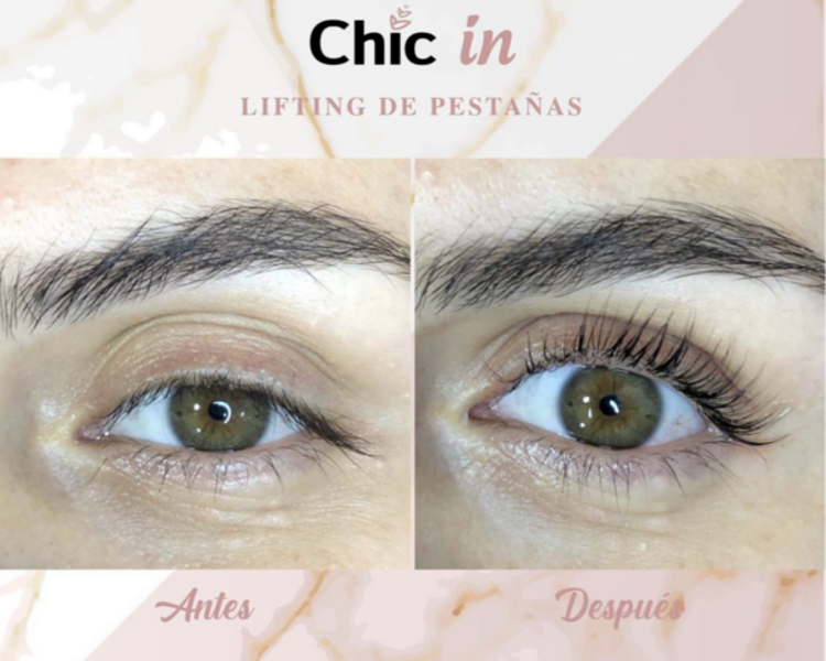 Lifting de pestañas