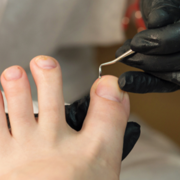 Servicio de Podología