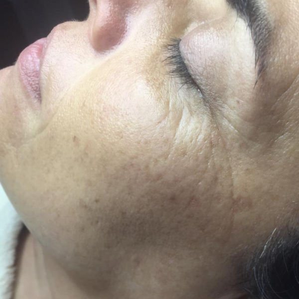 Higiene facial basica 