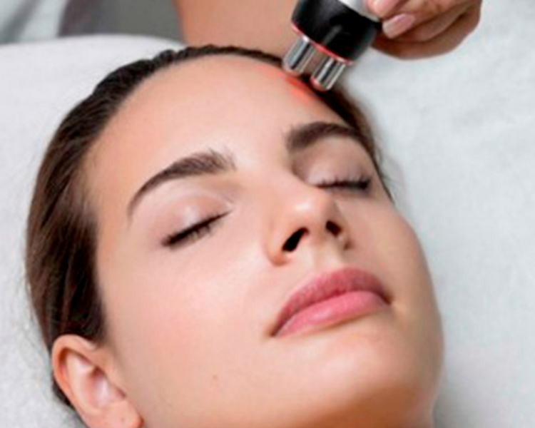 Radiofrecuencia facial