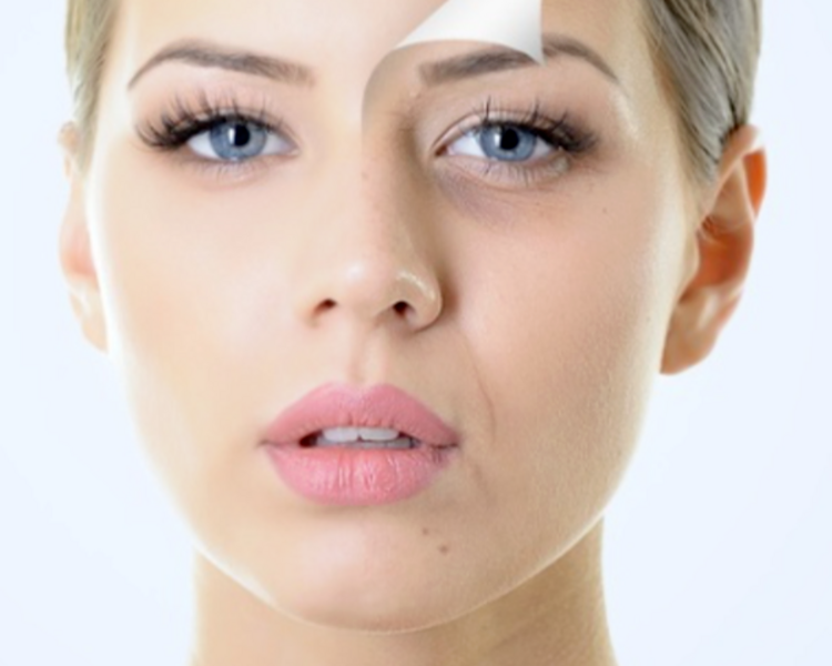 Peeling químico/mecánico