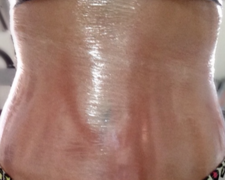 1 sesión - cavitación + masaje + envoltura