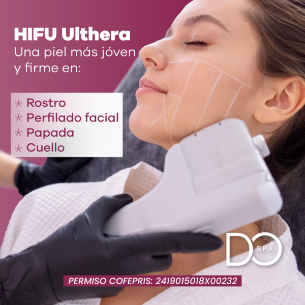 Rejuvenecimiento facial con HIFU Ulthera + radiofrecuencia + limpieza profunda