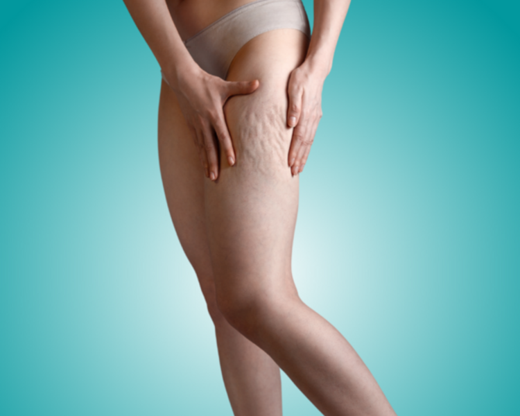 PRESOTERAPIA - 3 SESIONES