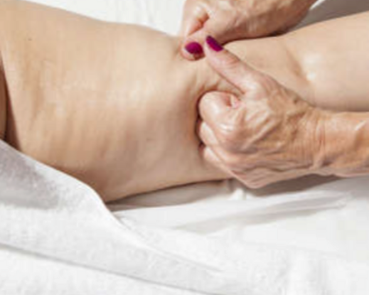 Masajes para celulitis 