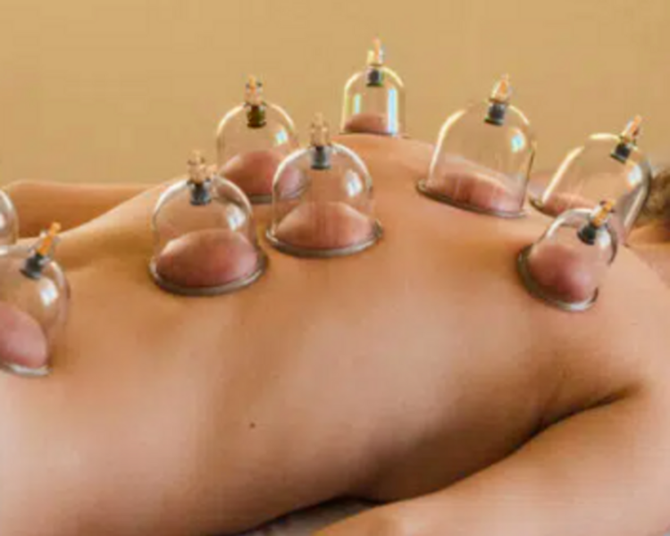 Masajes con ventosas