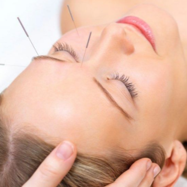 Acu facial 