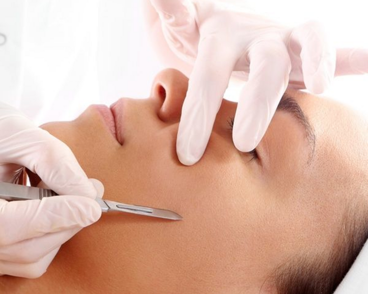 DERMAPLANING