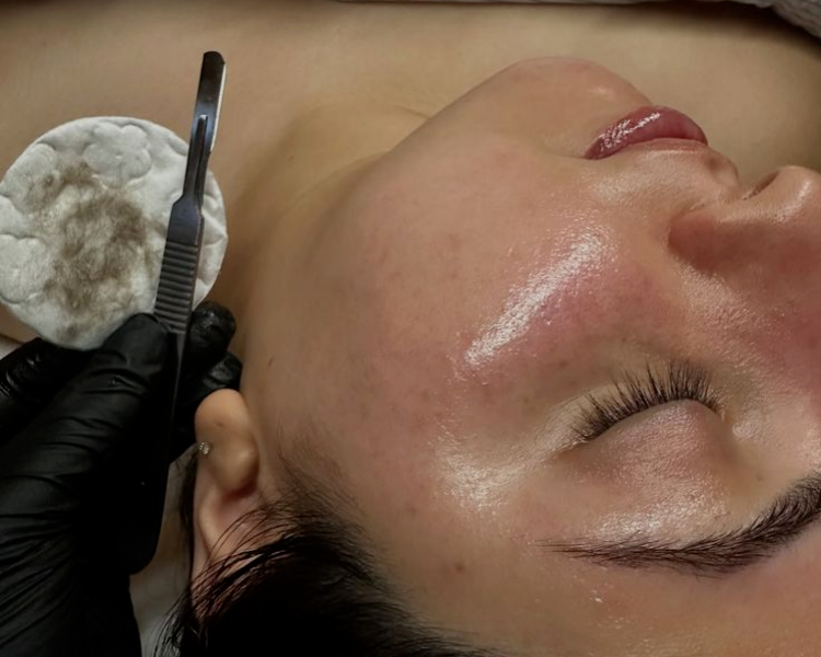 LIMPIEZA PROFUNDA + DERMAPLANING