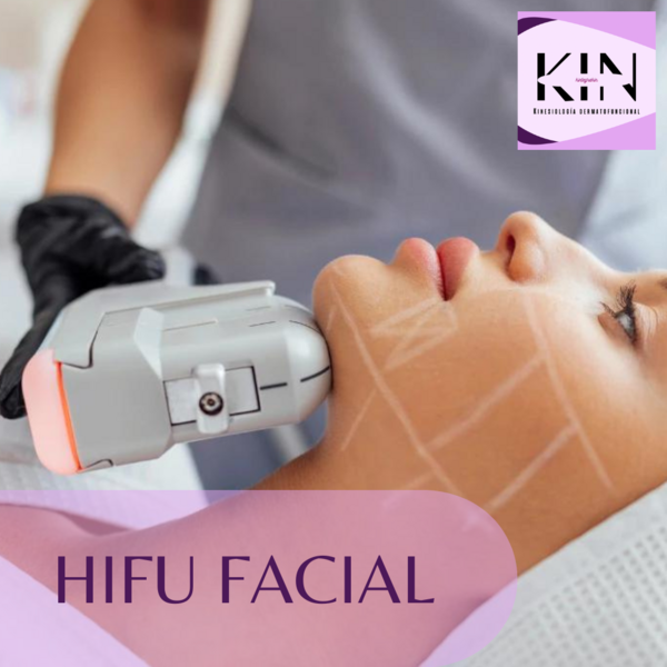 HIFU ROSTRO COMPLETO CON PAPADA