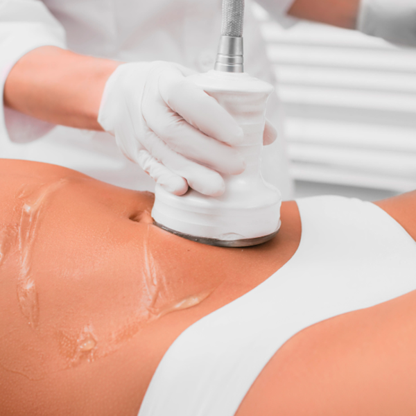 Ultracavitación + Electroestimulación