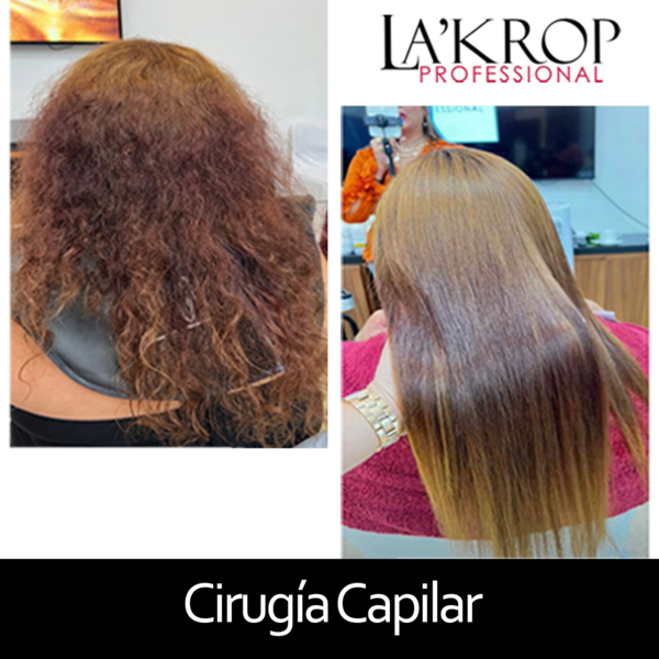 CIRUGIA CAPILAR