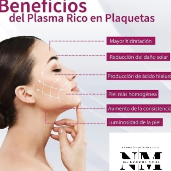 Plasma Rico en Plaquetas facial