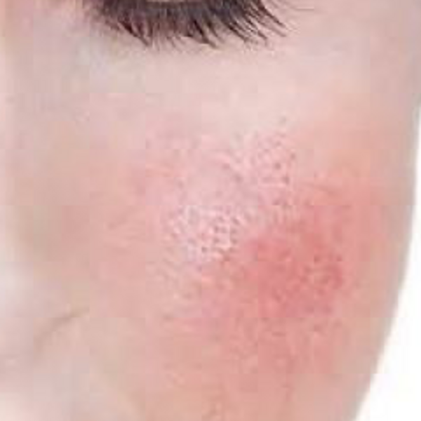 Peeling Argilac Pieles sensibles 