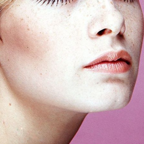 Depilación Láser Barba 12 Sesiones