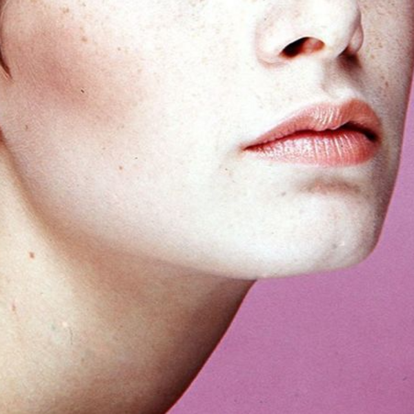 Depilación de Barba por Sesión