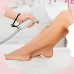 Operadora Depilación definitiva 