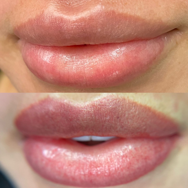 Micropigmentacion de Labios 