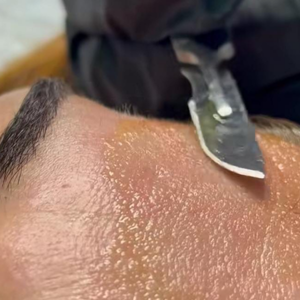 Dermaplaning