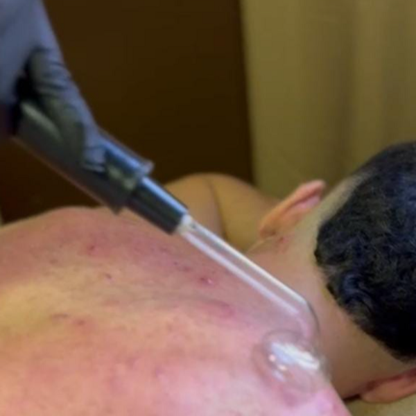 Exfoliación corporal cuerpo completo