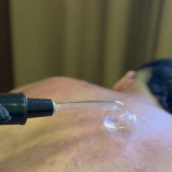 Exfoliación una zona corporal
