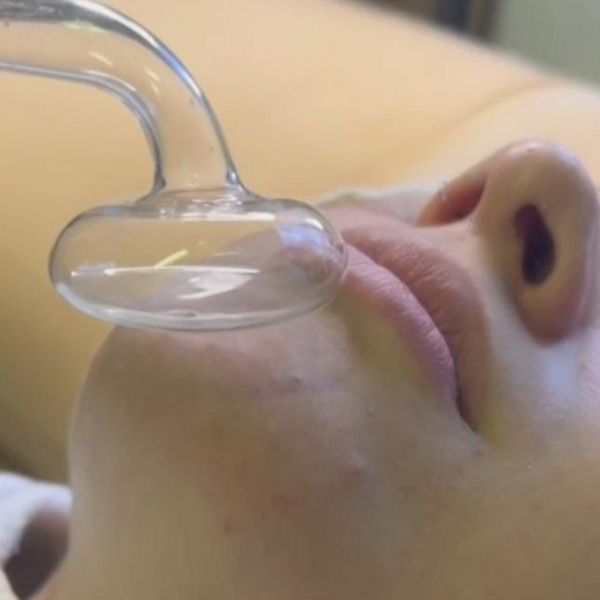 Exfoliación facial